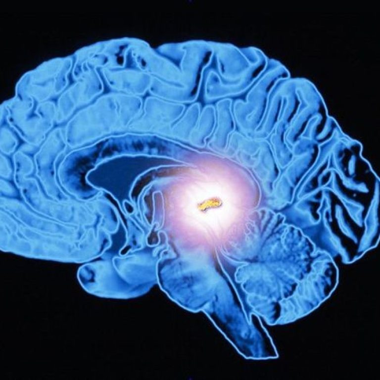 Learn More About the Function and Location of the Pineal Gland (1)